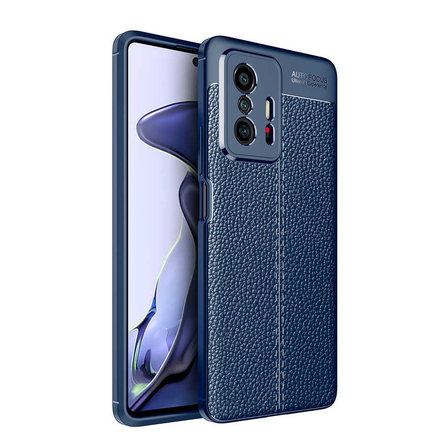 Cepax Niss Xiaomi Mi 11T 5G Silikon Telefon Kılıfı